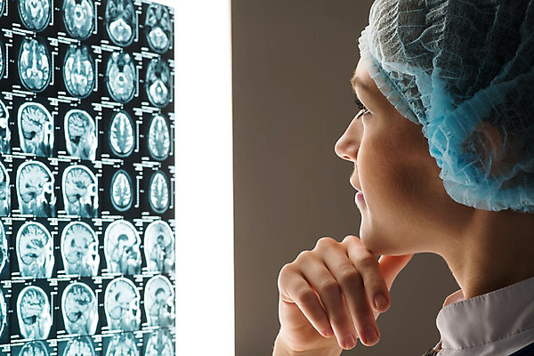 포토 JPG 해외이미지 백인 직업 응시 여자 백그라운드 신체 청진기 뼈 엑스레이 건강 병원 실험 한명 사람 성인 파란색 약 건강관리 시험 간호사 의사 코트 흰색 실험실 질병 뇌 암 궤 돌봄 소아과의사 해외202004 해외202105 해외포토 서양인 1 시선 교육 컬러 의학 의료기기 모션 관리 외투 의료진 파일형식