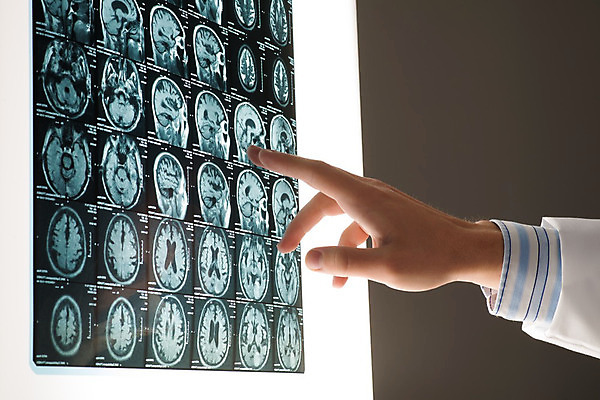 포토 JPG 해외이미지 동물 손 응시 백그라운드 신체 손가락 해부 추상 뼈 병원 사람없음 그래픽 약 카메라 고양이 시험 의사 긴급 잡기 닫기 질병 필름 분석 확인 뇌 관절염 방광 골절 깨짐 돌봄 심장병 정형외과 해외202004 해외202105 해외포토 시선 교육 컨셉 무늬 포유류 의학 모션 신체부위 전자제품 반려동물 의료진 비뇨기관 파일형식