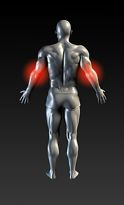 포토 JPG 해외이미지 남자 스포츠 신체 해부 근육 엑스레이 건강 병원 사람 사람없음 치료 빨간색 빛 세트 고통 정보 테니스 질병 수집 관절염 지역 팔 광 물리치료 방사선 정형외과 조언 치유 팔꿈치 시리즈 해외202004 해외202105 해외포토 감정 컬러 의학 신체부위 구기 파일형식