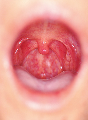 포토 JPG 신체 의학 치과 병원 입벌림 한명 사람 근접촬영 내부 아웃포커스 신체부위 치료 입 구강 혀 목젖 국내포토 1 뷰포인트 촬영기법 표정 파일형식