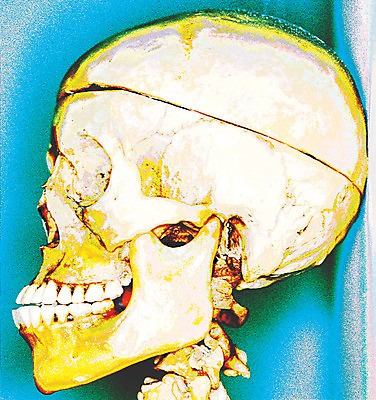 포토 JPG 얼굴 신체 인체모형 의료기기 해골 사람모양 사람없음 옆모습 치료 한개 머리 모형 기계 기구 도구 의료용품 오브젝트 두상 해골모형 국내포토 모양 1 뷰포인트 의학 뼈 신체부위 파일형식