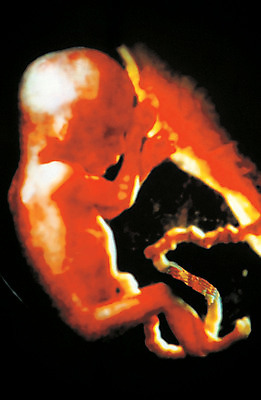 포토 JPG 의학 생명 병원 한명 사람 라이프 치료 임신 아기 출산 태교 산부인과 태아 양수 초음파 초음파사진 탯줄 아기만 국내포토 1 신체 생활 파일형식