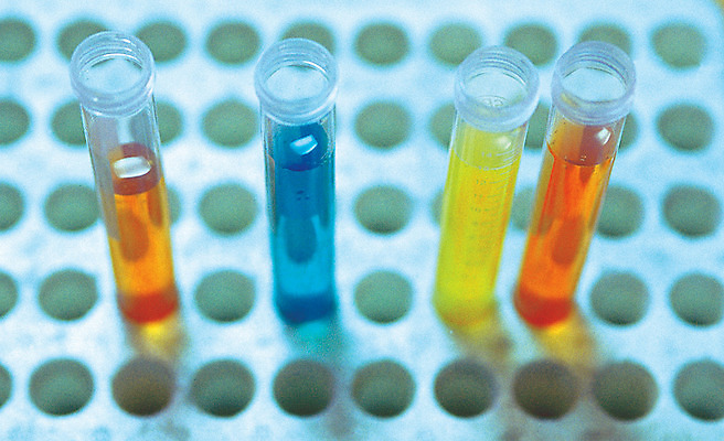 포토 JPG 과학 의료기기 유리 생명 실내 실험기구 실험 근접촬영 사람없음 라이프 아웃포커스 치료 하이앵글 컬러풀 숫자 여러개 기구 도구 관찰 의료용품 액체 생명공학 측정 오브젝트 시험관 눈금 치수 국내포토 문자 뷰포인트 컬러 다수 의학 모션 재질 촬영기법 내부 생활 파일형식