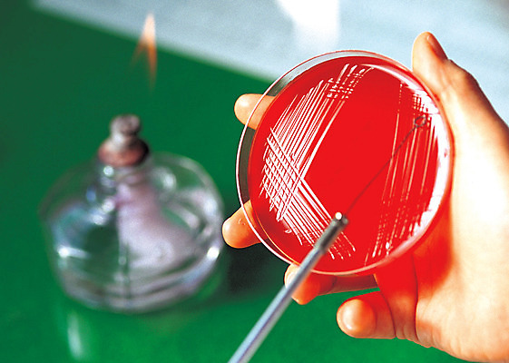 포토 JPG 손 의학 생명 병원 실험기구 실험 박사 한명 들기 근접촬영 라이프 아웃포커스 신체부위 치료 의사 도구 관찰 질병 생명공학 연구원 알코올램프 샬레 국내포토 직업 1 뷰포인트 과학 모션 촬영기법 사람 생활 의료진 파일형식