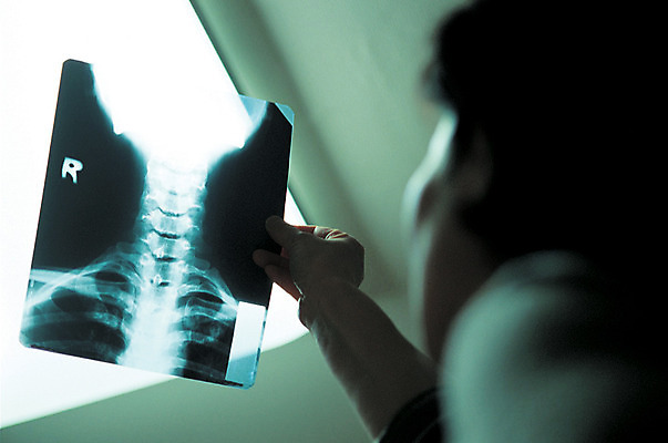 포토 JPG 응시 남자 투시 엑스레이 실내 병원 한명 들기 사람 동양인 근접촬영 성인 아웃포커스 치료 진료 의료진 의사 기구 도구 영상 방사선 의료기관 남자만 남자한명만 성인남자만 성인만 국내포토 직업 1 시선 뷰포인트 의학 모션 촬영기법 인종 내부 파일형식