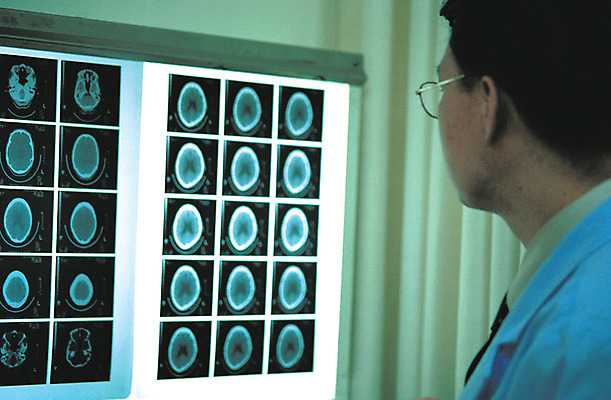 포토 JPG 응시 남자 투시 엑스레이 실내 병원 한명 사람 동양인 성인 치료 진료 의료진 의사 기구 도구 영상 방사선 의료기관 남자만 남자한명만 성인남자만 성인만 국내포토 직업 1 시선 의학 인종 내부 파일형식