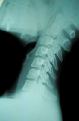 포토 JPG 신체 투시 뼈 엑스레이 병원 사람없음 치료 기구 도구 척추 영상 목 목뼈 방사선 국내포토 의학 신체부위 파일형식