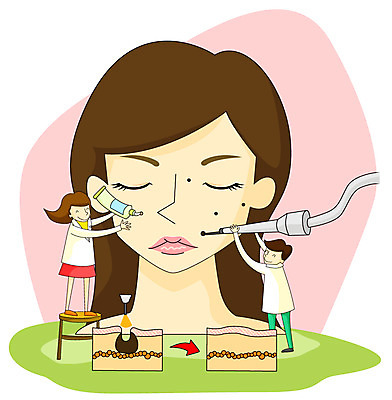 EPS 여자 남자 얼굴 일러스트 건강 웃음 사람 두명 치료 건강관리 환자 간호사 의사 도움 보호 질병 질병관리 시술 레이저수술 피부과 피부과의사 국내일러스트 컨셉 의학 표정 병원 관리 신체부위 의료진 파일형식 벡터