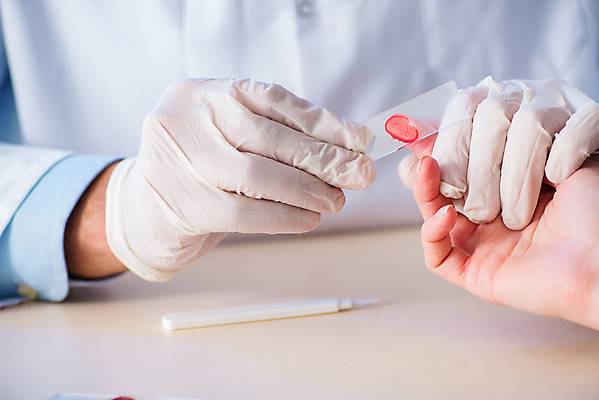 포토 JPG 해외이미지 손 손가락 의학 실내 병원 들기 신체부위 잡기 혈액 누름 혈액검사 혈액채취 해외202105 해외포토 모션 사람 내부 검사_조사 파일형식