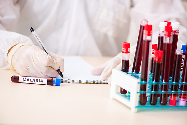 포토 JPG 해외이미지 학생 유리 건강 실험 사람없음 빨간색 약 시험 의사 기록 도움 혈액 실험실 바이러스 결과 생명공학 연구원 수집 과학자 분석 확인 사인 생물학 감염 수납 튜브 박테리아 백신 화학물질 화학자 항생제 해외202105 해외포토 직업 교육 컬러 과학 컨셉 의학 재질 의료진 화학 학자 파일형식