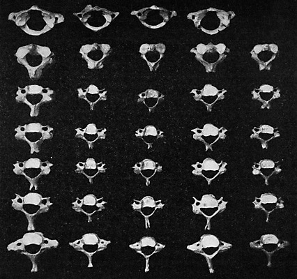 포토 JPG 해외이미지 유럽 과학 2 일러스트 해부 탁자 골격 미술 사람 사람없음 검은색 수확 골동품 흰색 기둥 역사 척추 그림 생물학 판화 난쟁이 연골 옛날 불규칙 해외202004 해외202105 해외포토 교육 건축 나라 컬러 가구 컨셉 농업 의학 문화예술 뼈 파일형식