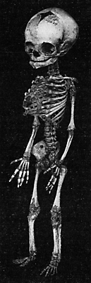 포토 JPG 해외이미지 어린이 과학 일러스트 해부 뼈 골격 미술 사람 소년 사람없음 검은색 수확 골동품 흰색 신생아 조직 역사 척추 그림 팔 판화 길이 똑같은 옛날 해골모형 해외202004 해외202105 해외포토 남자 컬러 농업 의학 문화예술 신체부위 모형 아기 파일형식