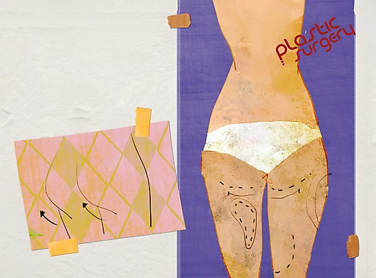 PSD 우먼라이프 라이프스타일 여자 일러스트 한명 서기 사람 성인 라이프 신체부위 뷰티 변화 성형수술 엉덩이 지방흡입 여자만 여자한명만 성인여자만 성인만 국내일러스트 1 컨셉 모션 생활 수술 파일형식