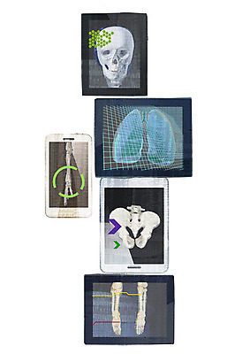 PSD 라이프스타일 일러스트 통신 손가락 모바일 무선통신 뼈 엑스레이 정보기술 사람없음 라이프 치료 전자제품 스마트폰 핸드폰 컴퓨터 태블릿 스크린 터치 정보 다리 장기 전화기 스마트 IT라이프 골반 편리함 소통 두골 국내일러스트 손 컨셉 신체 의학 기술 생활 신체부위 스마트기기 파일형식