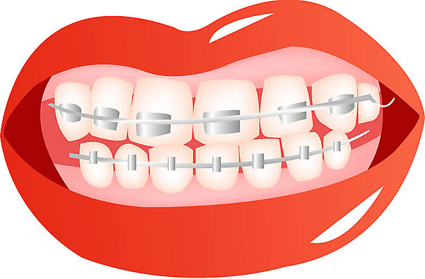 EPS 클립아트 신체 일러스트 치과 사람 신체부위 입 치아 입술 교정 치아교정 국내일러스트 병원 소화기관 파일형식 벡터