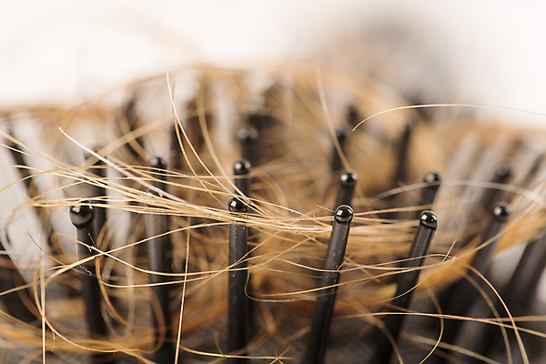 포토 JPG 해외이미지 근접촬영 사람없음 아웃포커스 뷰티 머리카락 머리빗 엉킴 흰배경 두피케어 탈모 탈모클리닉 해외202004 탈모예방 해외포토 뷰포인트 백그라운드 촬영기법 머리 흰색 미용용품 예방 클리닉 헤어관리 증상 파일형식 이미지허브