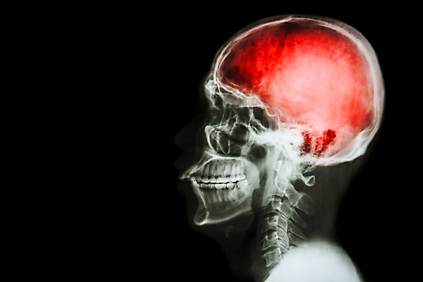 포토 JPG 해외이미지 해부 뼈 엑스레이 건강 병원 사람 옆모습 약 고통 환자 의사 질병 척추 뇌 두통 목 타격 해골모형 해외202004 해외포토 감정 뷰포인트 의학 모션 신체부위 모형 의료진 파일형식 이미지허브