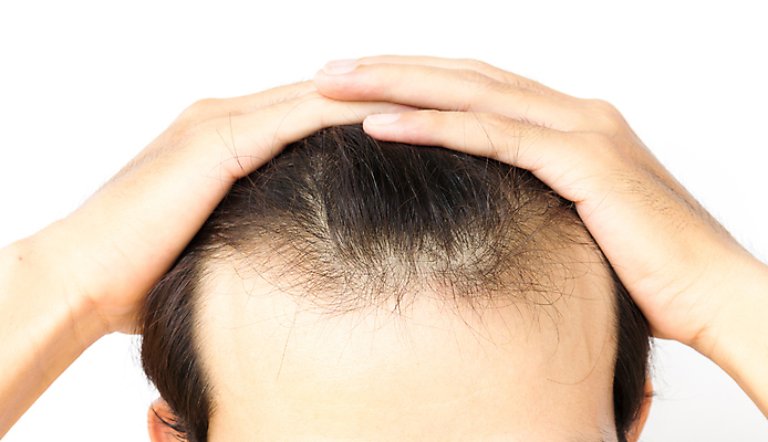 포토 JPG 해외이미지 남자 한명 상반신 성인 뷰티 머리카락 머리 잡기 흰배경 두피관리 두피케어 탈모 탈모클리닉 성인남자한명만 해외202004 탈모예방 해외포토 1 백그라운드 모션 사람 신체부위 흰색 예방 클리닉 헤어관리 증상 남자한명만 성인남자만 파일형식 이미지허브