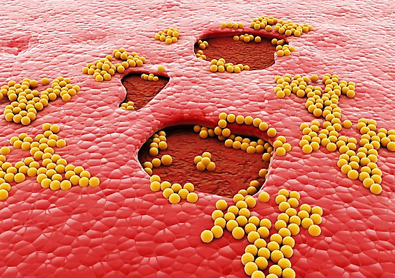 PSD 컬러 백그라운드 신체 의학 생명 세포 현미경 사람없음 라이프 그래픽 치료 빨간색 3D소스 3D 조직 상처 생명공학 피부 입체 박테리아 실험기구 생활 신체부위 디지털합성 파일형식