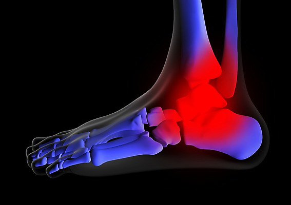 PSD 신체 해부 의학 투시 발 뼈 골격 엑스레이 건강 병원 사람없음 신체부위 그래픽 치료 3D소스 3D 입체 발가락 발목 발가락뼈 발뼈 사람 디지털합성 파일형식