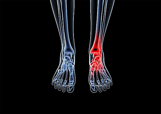 PSD 신체 해부 의학 투시 발 골격 엑스레이 건강 병원 사람없음 신체부위 그래픽 치료 3D소스 3D 다리 입체 발가락 발목 다리뼈 발가락뼈 발뼈 뼈 사람 디지털합성 파일형식