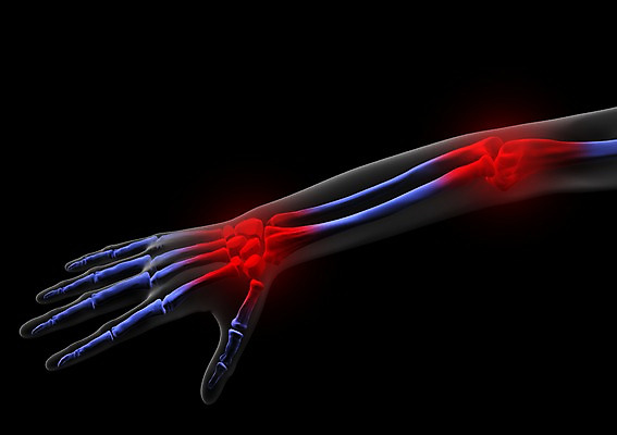 PSD 손 신체 손가락 해부 의학 투시 뼈 골격 엑스레이 건강 병원 사람없음 신체부위 그래픽 치료 3D소스 3D 손목 입체 팔 손가락뼈 사람 디지털합성 파일형식