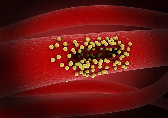 PSD 컬러 백그라운드 신체 의학 생명 세포 현미경 사람없음 라이프 그래픽 치료 빨간색 3D소스 3D 조직 혈액 생명공학 입체 혈관 박테리아 혈소판 실험기구 생활 장기_의학 디지털합성 파일형식