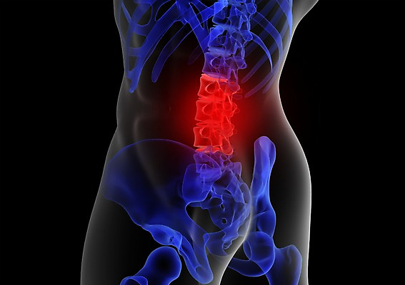 PSD 신체 해부 의학 투시 뼈 골격 엑스레이 건강 병원 사람없음 신체부위 그래픽 치료 3D소스 3D 디스크 장기 허리 척추 입체 관절 허리디스크 사람 디스크_질병 질병 디지털합성 파일형식