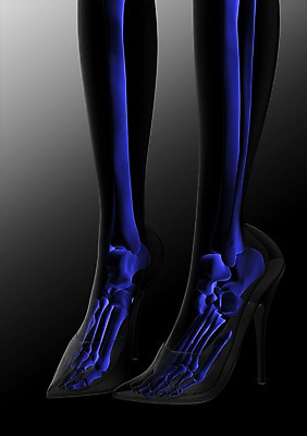 PSD 편집이미지 잡화 구두 신발 신체 해부 의학 투시 발 골격 엑스레이 건강 병원 사람없음 신체부위 그래픽 치료 3D소스 3D 다리 하이힐 분석 입체 발가락 종아리 다리뼈 발가락뼈 발뼈 편집소스 편집3D 컨셉 뼈 사람 여성화 디지털합성 파일형식