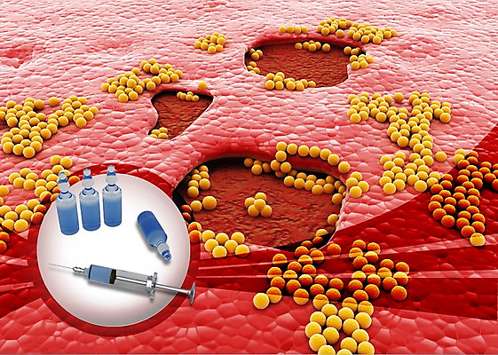 PSD 편집 편집이미지 컬러 백그라운드 신체 의학 의료기기 생명 세포 건강 현미경 주사기 사람없음 라이프 그래픽 치료 빨간색 약 3D 의료용품 바늘 조직 상처 생명공학 피부 입체 주사약 수술도구 박테리아 편집3D 실험기구 생활 신체부위 도구 의학용품 디지털합성 파일형식