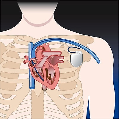 EPS 해외이미지 일러스트 하트 심장 계획 스케치 외과 정맥 심장병 해외202004 해외일러스트 모양 컨셉 의학 병원 미술 장기 질병 혈관 파일형식 벡터 이미지허브