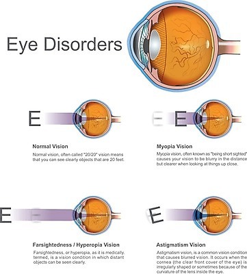 EPS 해외이미지 응시 안경 과학 곡선 신체 일러스트 해부 발 거리 사람 그래픽 파란색 감각 오르간 질병 눈동자 오브젝트 검사 시력 슛 비전 시력검사 게이지 돌봄 해외202004 해외일러스트 시선 잡화 선 컬러 의학 모션 신체부위 눈 건반악기 안구 파일형식 벡터 이미지허브