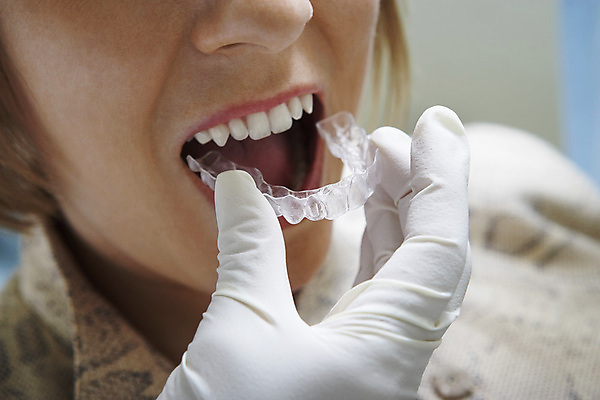 포토 JPG 해외이미지 백인 직업 여자 2 실내 건강 치과 사람 20대 성인 두명 30대 환자 업무 오픈 쌍 입 치아 곰팡이 위생관리 해외202004 해외포토 서양인 의학 병원 관리 청년 내부 신체부위 장년 작업 소화기관 파일형식 이미지허브