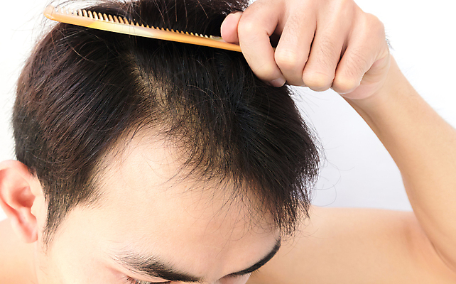 포토 JPG 해외이미지 남자 한명 들기 상반신 성인 뷰티 머리카락 머리빗 흰배경 두피관리 두피케어 탈모 탈모클리닉 성인남자한명만 해외202004 탈모예방 해외포토 1 백그라운드 모션 사람 머리 흰색 미용용품 예방 클리닉 헤어관리 증상 남자한명만 성인남자만 파일형식 이미지허브