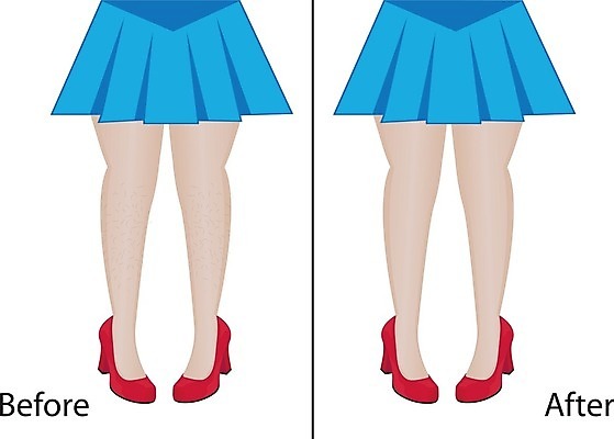 EPS 해외이미지 모델 템플릿 디자인 여자 포스터 신체 일러스트 유행 상점 화장품 흰색 막대기 매끈함 심볼 피부 스킨케어 면도기 순서 삭제 돌봄 바디케어 왁스 위생관리 제모 전후 해외202004 해외일러스트 컬러 모션 관리 사람 신체부위 위생용품 뷰티 감각 비교 파일형식 벡터 이미지허브