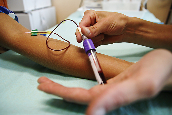 포토 JPG 해외이미지 손 상반신 성인 신체부위 환자 잡기 팔 채혈 혈액검사 해외202004 해외포토 의학 모션 사람 검사_조사 파일형식 이미지허브