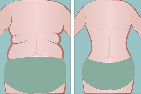 EPS 해외이미지 모양 라이프스타일 여자 신체 다이어트 일러스트 건강 운동 숫자 흰색 수술 몸무게 큼 엉덩이 비만 날씬함 허리 연습 외과 돌봄 얇은 적자 해로움 전후 셀룰라이트 해외202004 해외일러스트 문자 컬러 컨셉 의학 모션 병원 사람 생활 신체부위 비교 크기 몸매 파일형식 벡터 이미지허브