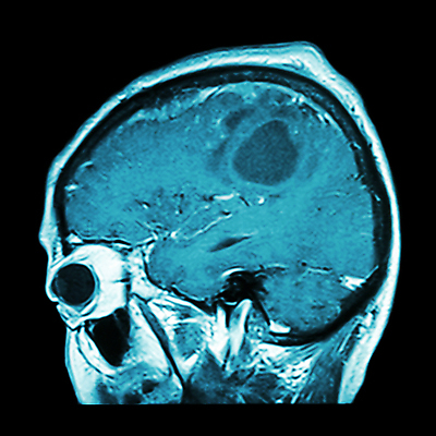 포토 JPG 해외이미지 해부 엑스레이 병원 사람 사람없음 컴퓨터 머리 고양이 고통 환자 의사 광선 질병 X 불안 뇌 두통 시스템 암 외과 덩어리 고립 종양 타격 해골모형 해외202004 해외포토 알파벳 감정 포유류 의학 모션 신체부위 전자제품 반려동물 모형 의료진 파일형식 이미지허브