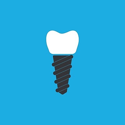 EPS 해외이미지 디자인 컨셉 일러스트 해부 왕관 건강 치과 병원 그래픽 치료 파란색 약 금속 흰색 나사 입 플랫 치아 심볼 오브젝트 사인 치과의사 뿌리 외과 틀니 고립 돌봄 보철 위생관리 인공 철강 치아교정 티타늄 해외202004 해외일러스트 컬러 의학 모션 재질 관리 신체부위 의사 공구 소화기관 원소 교정 파일형식 벡터 이미지허브