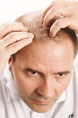 포토 JPG 해외이미지 백인 헤어스타일 남자 얼굴 과학 부분 수염 건강 한명 사람 성인 치료 약 갈색 머리 활발 흰색 머리빗 점 질병 정상 자르기 피부 대머리 돌봄 적자 스타일 해외202004 해외포토 서양인 1 컬러 컨셉 의학 모션 신체부위 미용용품 파일형식 이미지허브