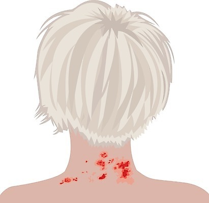 EPS 해외이미지 신체 일러스트 세포 건강 사람 빨간색 약 환경오염 바이러스 질병 폭발 피부 감염 전염 우표 박테리아 돌봄 증상 해외202004 해외일러스트 컬러 컨셉 의학 모션 신체부위 파일형식 벡터 이미지허브