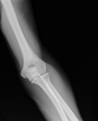 포토 JPG 해외이미지 남자 신체 해부 뼈 골격 엑스레이 건강 병원 사람 성인 사람없음 약 환자 광선 수술 사건 필름 생물학 팔 외과 방사선 해외202004 해외포토 교육 의학 신체부위 치료 파일형식 이미지허브