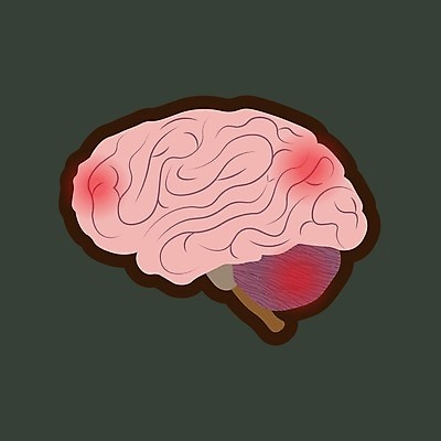 EPS 해외이미지 디자인 교육 실루엣 선 과학 백그라운드 컨셉 일러스트 해부 추상 아이디어 건강 창조 사람 그래픽 스터디 약 머리 마음 오르간 플랫 불안 심볼 사인 뇌 생물학 시스템 고립 염증 종양 지능 타격 편두통 해외202004 해외일러스트 감정 무늬 의학 모션 촬영기법 신체부위 학습 고통 건반악기 질병 파일형식 벡터 악기 건반 음악 문화예술 이미지허브