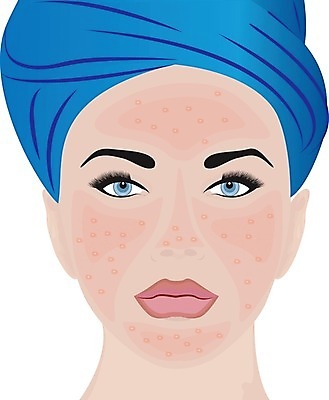 EPS 해외이미지 얼굴 일러스트 피부 문제 해외202004 해외일러스트 신체부위 파일형식 벡터 이미지허브