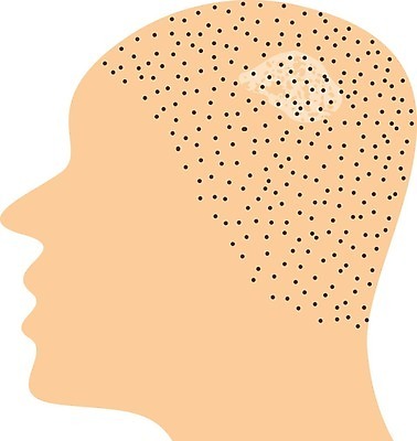 EPS 해외이미지 과학 백그라운드 신체 일러스트 건조 건강 치료 약 머리 버섯 고통 성장 흰색 질병 피부 유기농 생물학 감염 미생물 박테리아 고립 곰팡이 돌봄 이스트 전염병 페디큐어 해로움 해외202004 해외일러스트 웰빙 교육 감정 컬러 컨셉 의학 모션 생물 신체부위 뷰티 파일형식 벡터 이미지허브