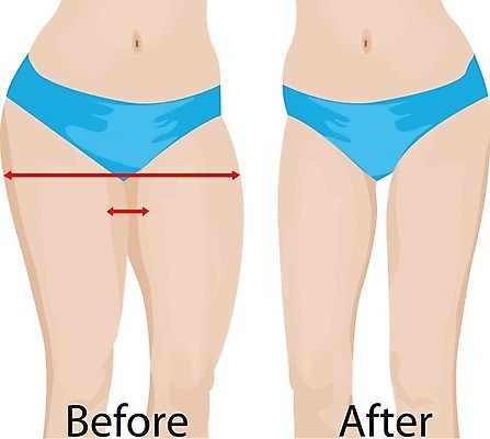 EPS 해외이미지 모양 라이프스타일 여자 스포츠 신체 일러스트 건강 운동 숫자 흰색 몸무게 큼 엉덩이 비만 날씬함 연습 돌봄 얇은 적자 셀룰라이트 해외202004 해외일러스트 문자 컬러 모션 사람 생활 신체부위 크기 몸매 파일형식 벡터 이미지허브