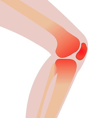 EPS 해외이미지 과학 컨셉 신체 일러스트 해부 건강 병원 사람 내부 치료 약 산책 손상 고통 환자 의사 대접 질병 상처 몸무게 위험 하락 사건 무릎 문제 무거움 테라피 돌봄 연골 증상 헬프 해외202004 해외일러스트 감정 의학 모션 휴식 신체부위 뷰티 의료진 도움 무게 파일형식 벡터 직업 이미지허브