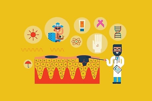 EPS 해외이미지 여자 남자 일러스트 건강 사람 성인 두명 태양 노란색 환자 의사 질병 DNA 피부 암 자외선 피부병 성인만 해외202004 피부층 해외일러스트 자연요소 컬러 의학 신체부위 의료진 생명공학 피부질환 파일형식 벡터 이미지허브