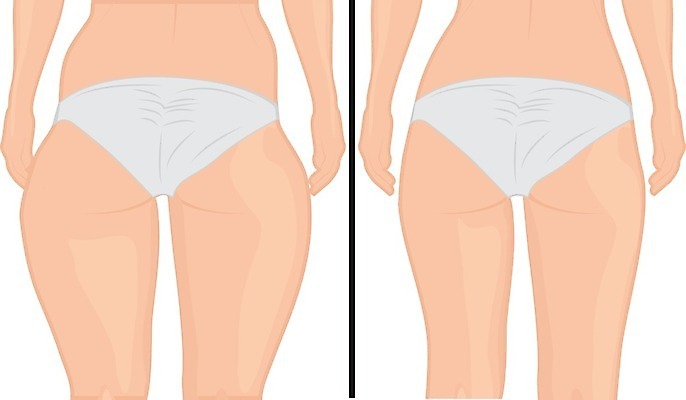 EPS 해외이미지 모양 라이프스타일 여자 스포츠 신체 다이어트 일러스트 건강 운동 숫자 흰색 수술 몸무게 엉덩이 비만 날씬함 허리 연습 외과 허벅지 얇은 적자 해로움 전후 셀룰라이트 해외202004 해외일러스트 문자 컬러 컨셉 의학 병원 사람 생활 신체부위 치료 비교 몸매 파일형식 벡터 이미지허브