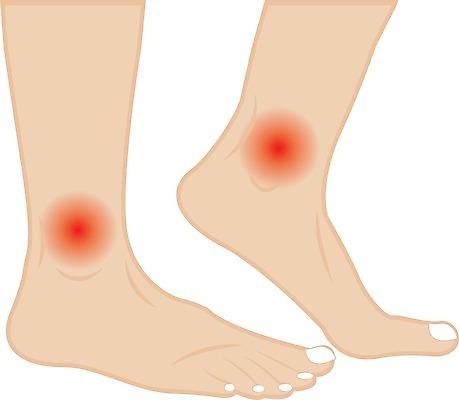 EPS 해외이미지 신체 일러스트 해부 건강 사람 치료 약 산책 손상 고통 의사 대접 질병 상처 하락 비만 문제 테라피 발목 압축 양발 연골 해외202004 해외일러스트 감정 컨셉 의학 발 휴식 뷰티 의료진 몸매 파일형식 벡터 이미지허브